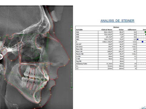Ejemplo de modelos de estudio y análisis cefalométrico