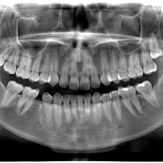 Ejemplo real de paquetes de ortodoncia tomada en El Radiológico Oral