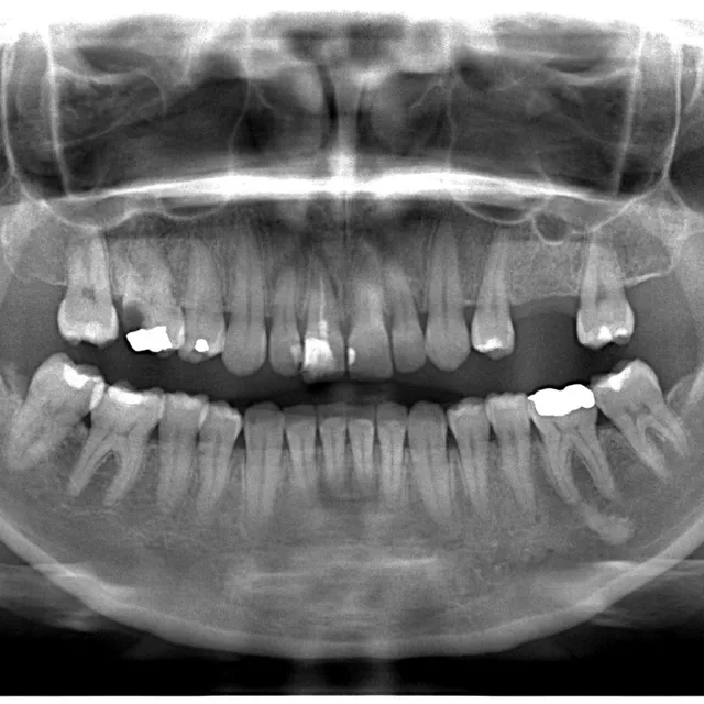 Ejemplo real de radiografías extraorales tomada en El Radiológico Oral