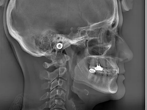 Ejemplo de paquetes de ortodoncia